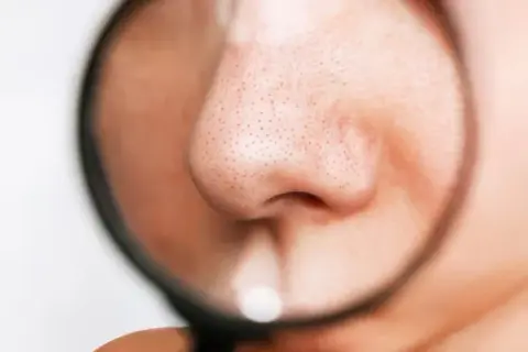 毛穴は「閉じる」ことができるのか：皮膚生理学が突きつける残酷な真実と希望